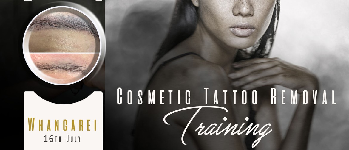 Cosmetic Tattoo Removal Education