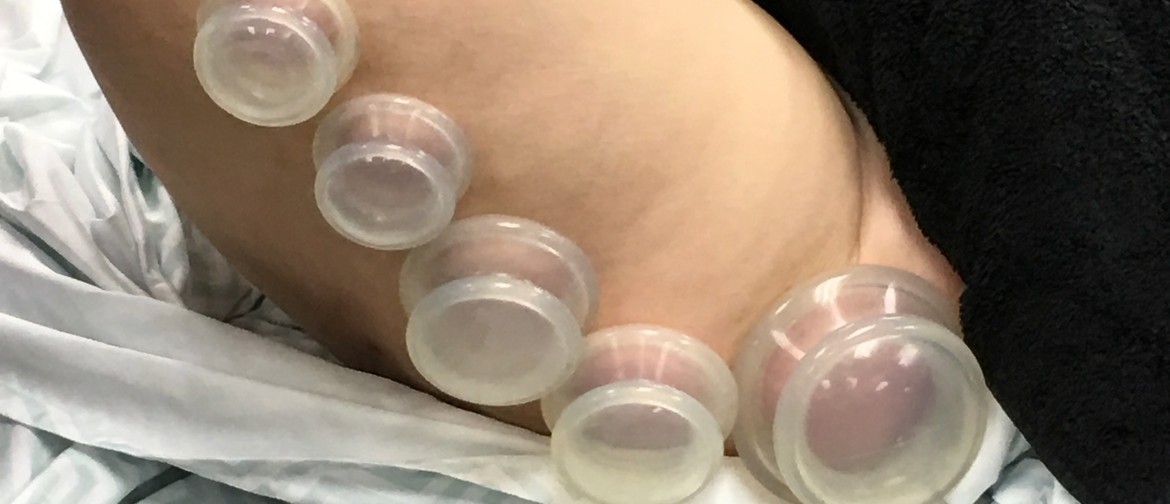 Introduction to Myofascial Cupping: CANCELLED